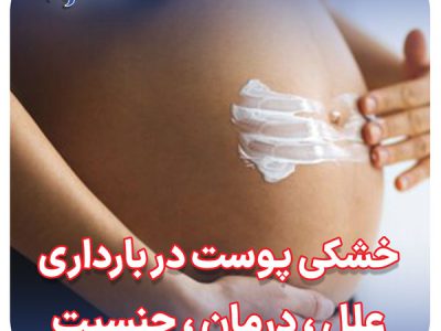 خشکی پوست پر بارداری درمان جنسیت جنین علل